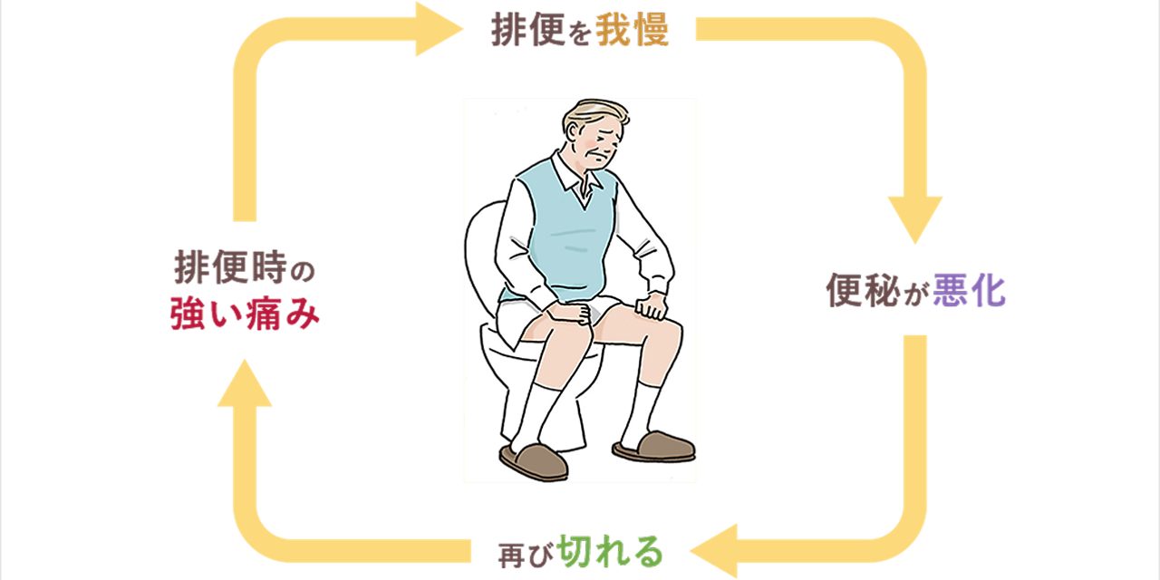 便秘と痔の関係