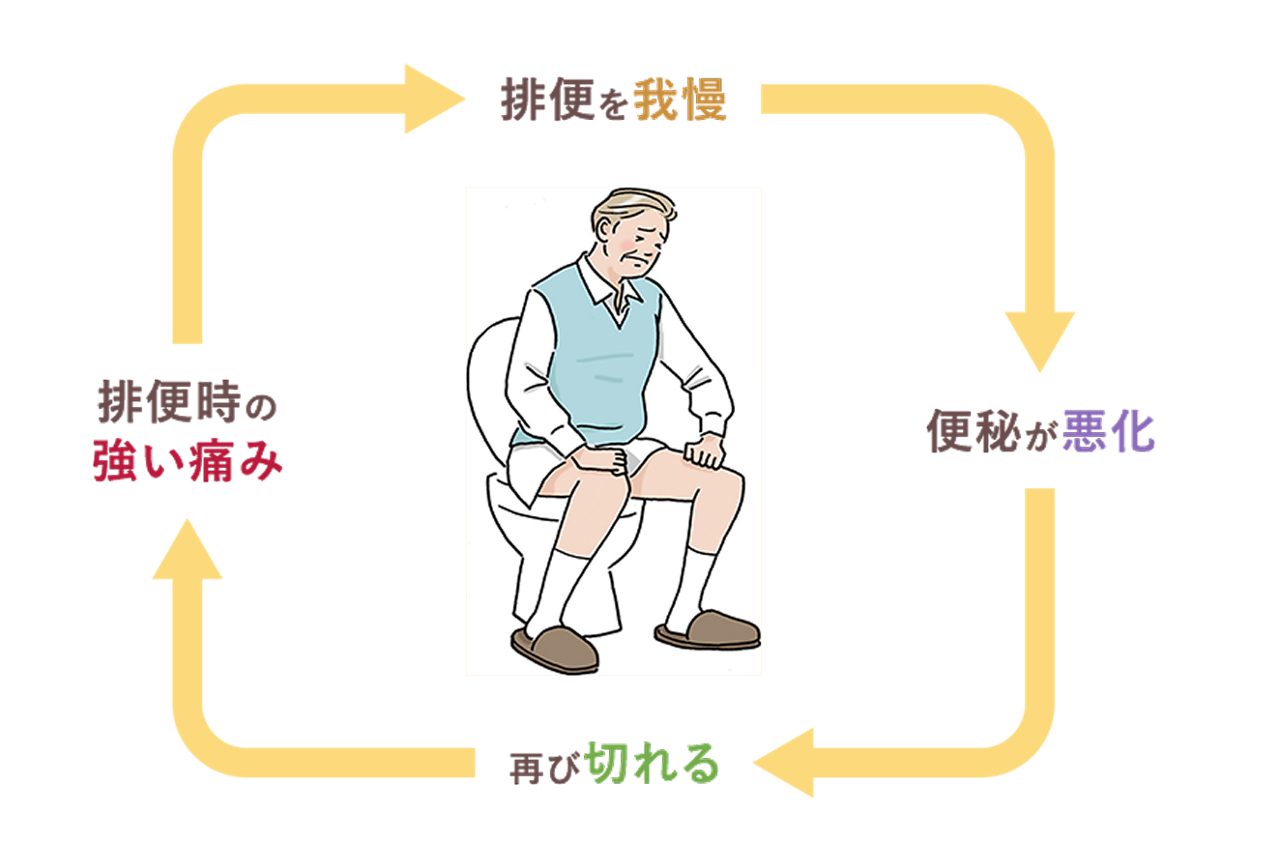便秘と痔の関係