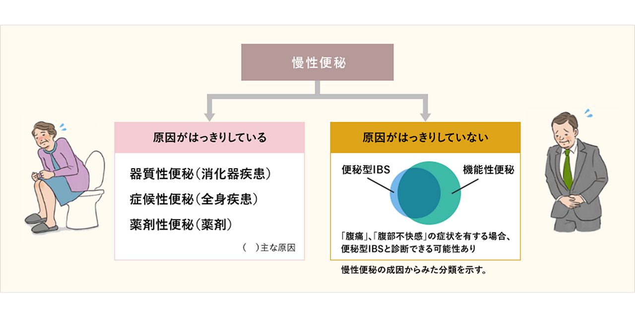 便秘の分類