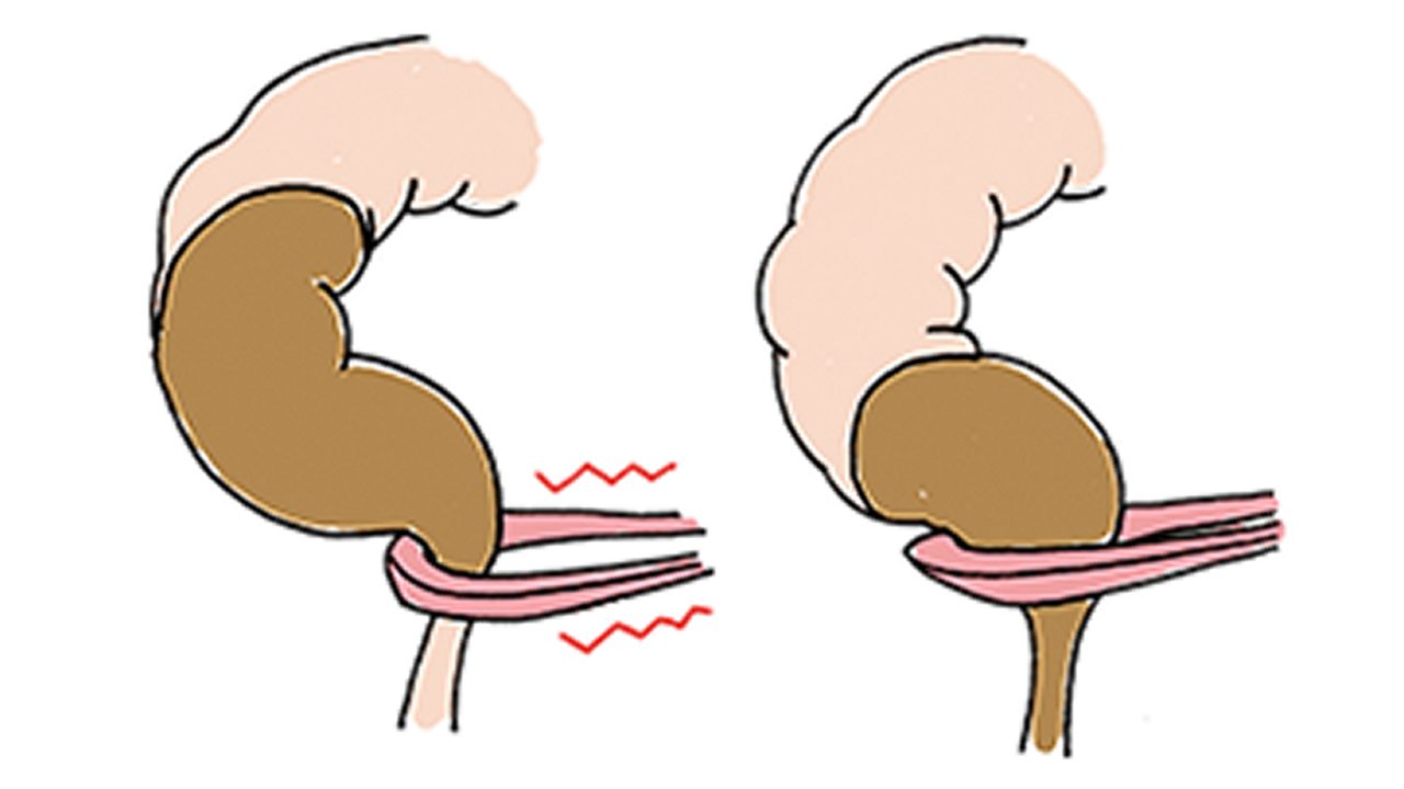 直腸・肛門付近の筋肉や感覚が弱まっている