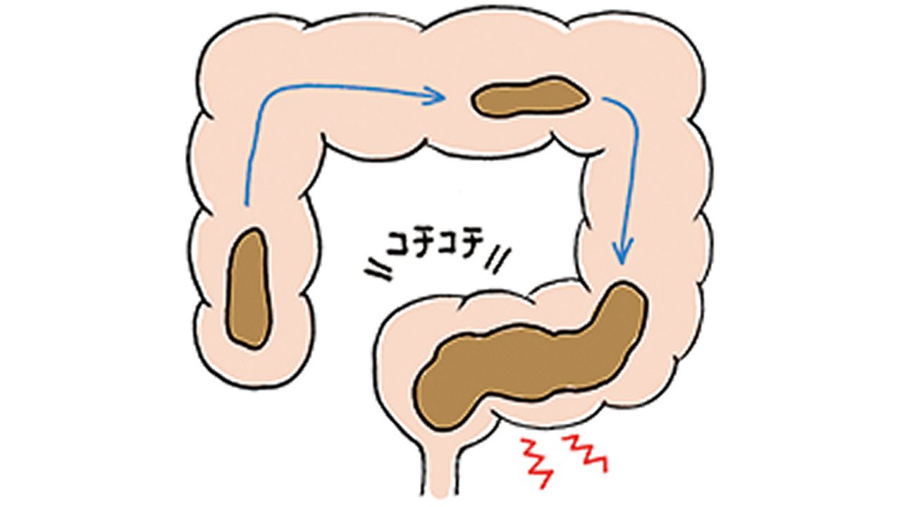 食事の量や水分が足りていない